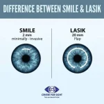 SMILE Versus LASIK