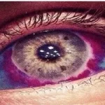 An Eye Tattoo Can Cost You Your Vision