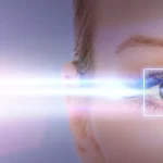 The most important questions to ask a LASIK surgeon?