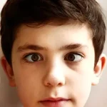 Everything You Need to Know About Strabismus Surgery