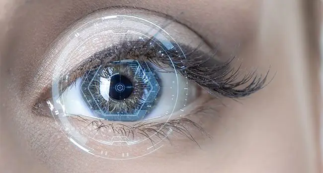 What is Implantable Collamer Lens?