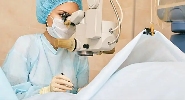 mics-cataract-surgery.