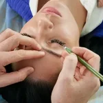 cosmetic-eye-surgery