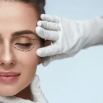 Blepharoplasty: A Sure-Shot Way to Remove A Tell-tale Sign of Ageing