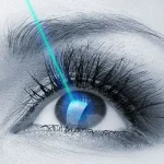 Retinal Tear Treatment to Prevent Blindness!