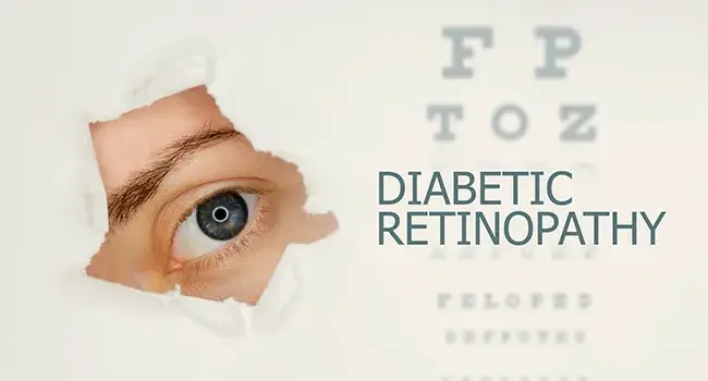 diabetic-retinopathy-learn-all-about-it_