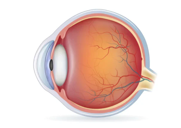 What-are-the-significant-causes-of-retina-tears