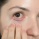 dry eye syndrome causes and treatments