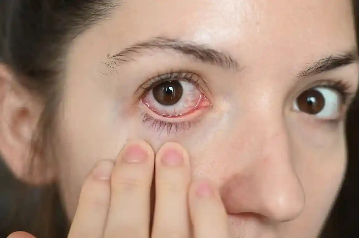 dry eye syndrome causes and treatments