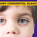 Primary-Congenital-Glaucoma-Causes-Symptoms-Treatments.