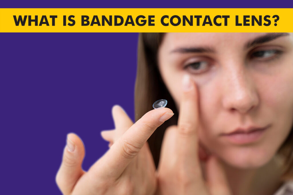 What Are Bandage Contact Lens? – Uses and Benefits