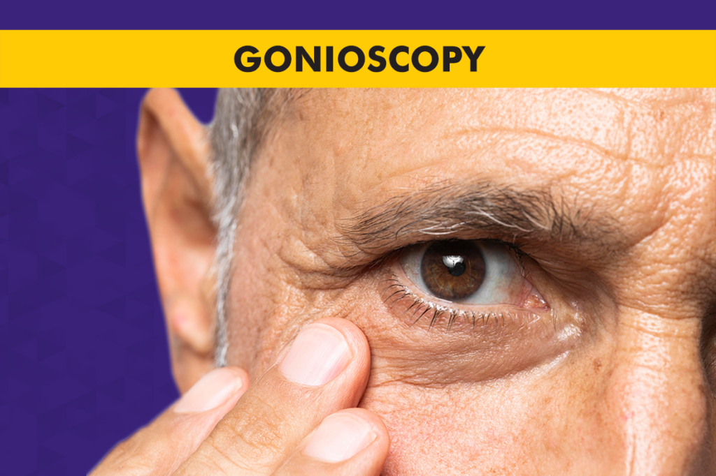 What Is Gonioscopy? What to Expect?