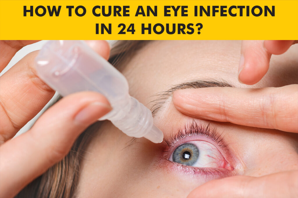 How to Cure an Eye Infection in 24 Hours: Tips and Treatments