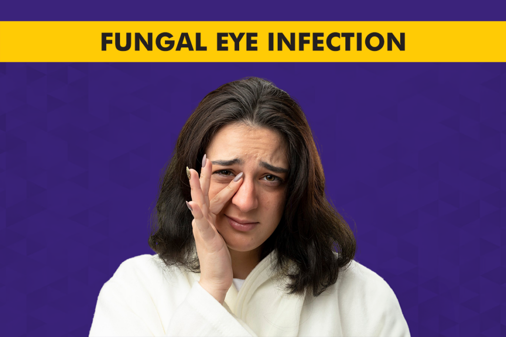 Fungal Eye Infection