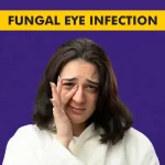 Fungal-Eye-Infection.