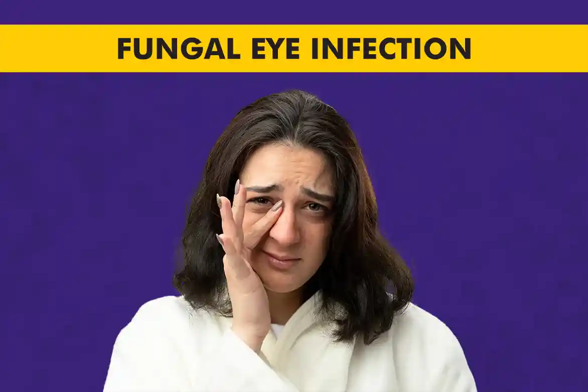 Fungal eye infection symptoms and treatment options at Centre for Sight.