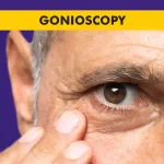 Gonioscopy