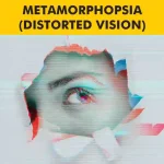 Metamorphopsia distorted vision graphic explaining its effects on sight