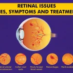 Retinal-Issues-Types-Symptoms-and-Treatments