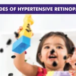 Grades of Hypertensive Retinopathy