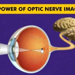 Seeing Beyond Vision: The Power of Optic Nerve Imaging