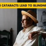 Can Cataracts Lead to Blindness